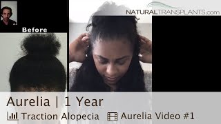 Hair Transplant for African American Female 1 Year Results | Dr. Blumenthal (Aurelia)