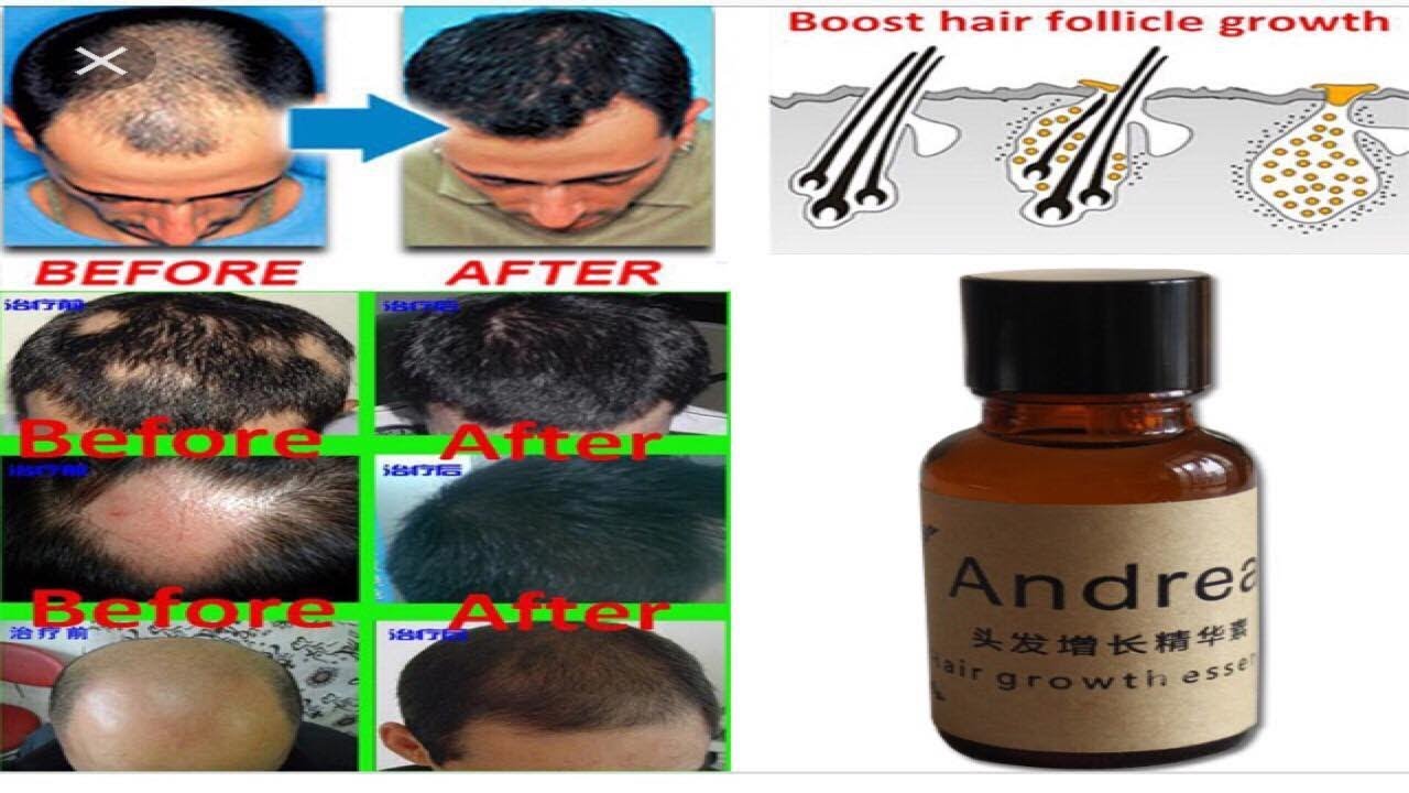 Andrea Hair Growth Essence Before And After