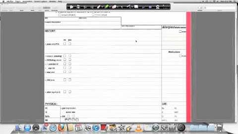 Introduction to the Anesthetic Record