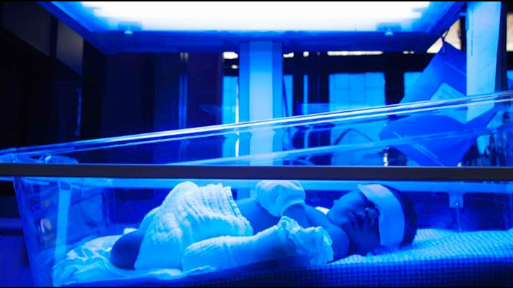 Jaundice, Hyperbilirubinemia and Kernicterus | Reiter & Walsh, P C  Birth Injury Videos