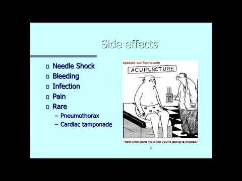 Evidence-based Use of Acupuncture