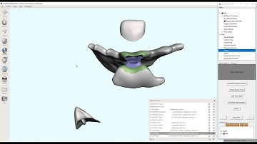 D3Lab x64  -  Flipper (Temporary Transitional Partial) Fabrication in Meshmixer