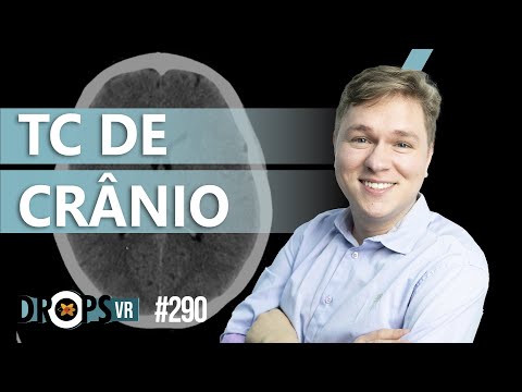 TC DE CRÂNIO