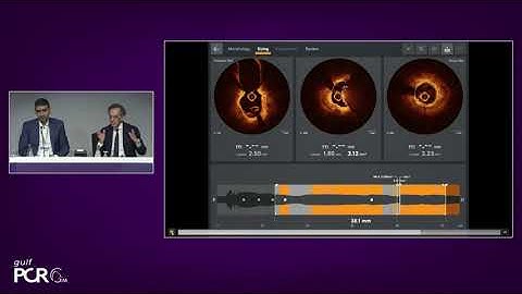 OCT & artificial intelligence:  new shiny light for better decision making - GulfPCR-GIM 2022