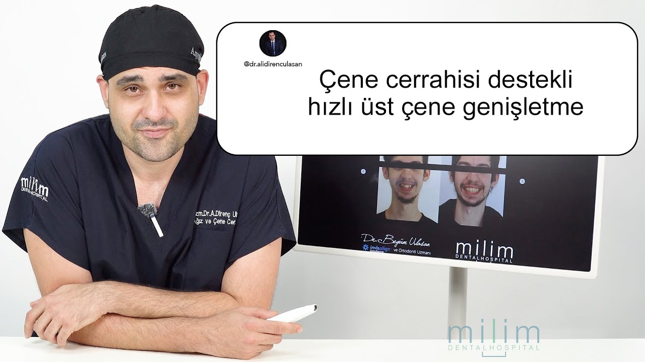 Çene Cerrahisi Destekli Hızlı Üst Çene Genişletme (SARPE) Nedir? | Milim Dental
