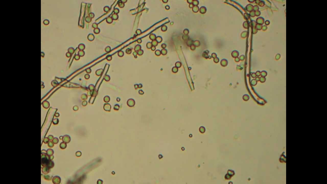 Find A Gas Station >> Aspergillus Oryzae - YouTube Find A Gas Station >> Aspergillus Oryzae - YouTube