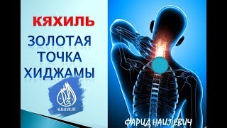 Золотая точка хиджамы alhajam.ru Золотая точка хиджамы alhajam.ru