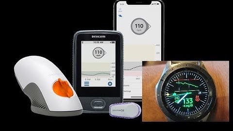 Install Dexcom Blood Glucose Monitoring On Your Smartwatch