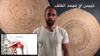 ٢١- تيبس الكتف اسبابه و علاجه عن طريق تمرين واحد . - تجمد مفصل الكتف