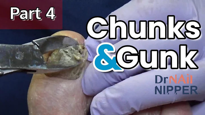 #4 Chunks and Gunk (2021)