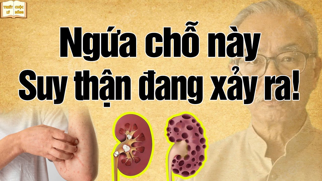 Cơ thể ngứa 5 chỗ này, Suy Thận Đang Xảy Ra - đừng coi thường dấu hiệu nhỏ