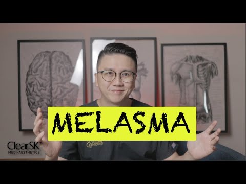 Video: Melasma - Rūšys, Priežastys, Gydymas