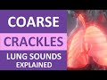 Understanding Coarse Crackles
