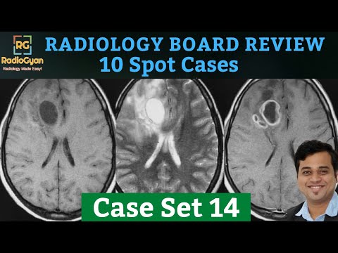 Radiology Board Core Exam Review Cases [Quiz and Discussion] | Set 14 | Dec 2020