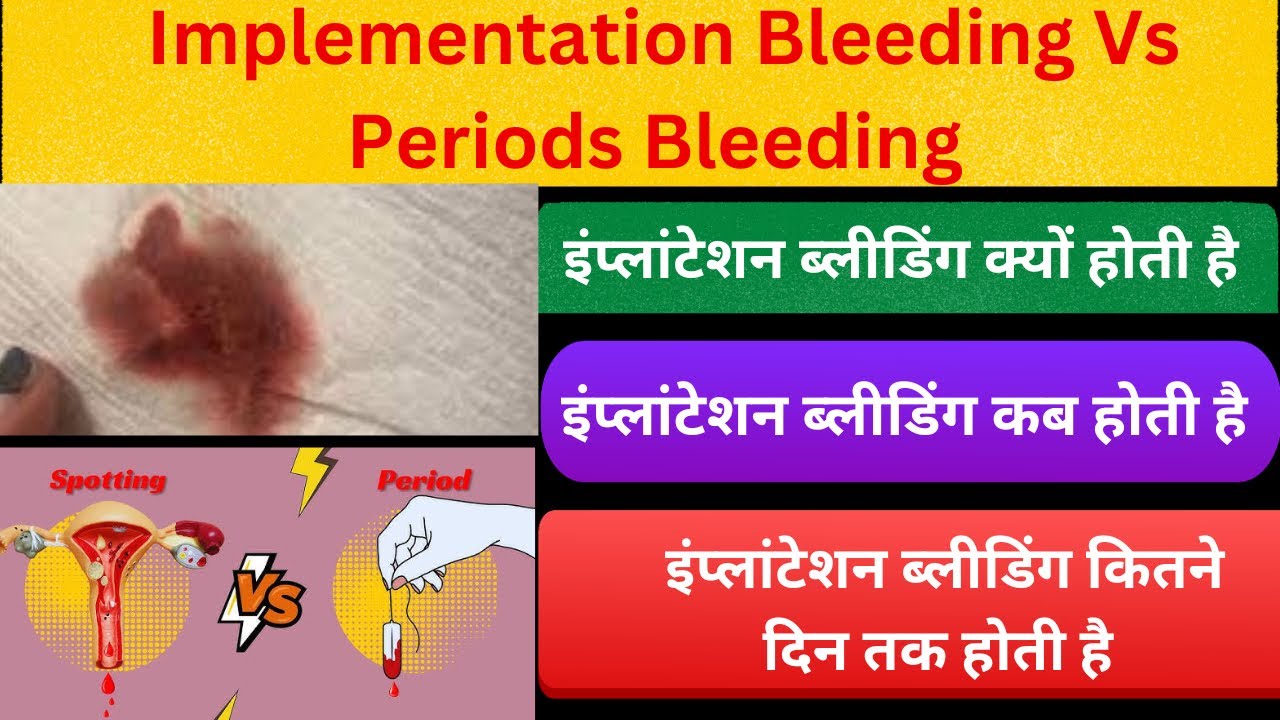 Implementation Bleeding Vs Periods Implantaion bleeding kya hoti hai