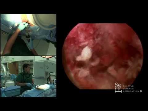 Preparing for your Endoscopy/Colonoscopy. Preparing for your Endoscopy/Colonoscopy.