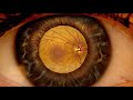 (Audio Described) Animation: Dilated Eye Exam