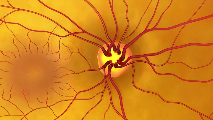 (Audio Described) Animation: Dilated Eye Exam