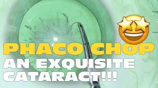 Phaco Clip #208 - Phaco Chop In Exquisite Post Uveitis Cataract
