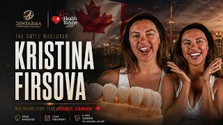 Smile Makeover | Real Patient Story from Canada 🇨🇦 #Allon4#Allon6#dentaltreatmentturkey#turkeyteeth Smile Makeover | Real Patient Story from Canada 🇨🇦 #Allon4#Allon6#dentaltreatmentturkey#turkeyteeth