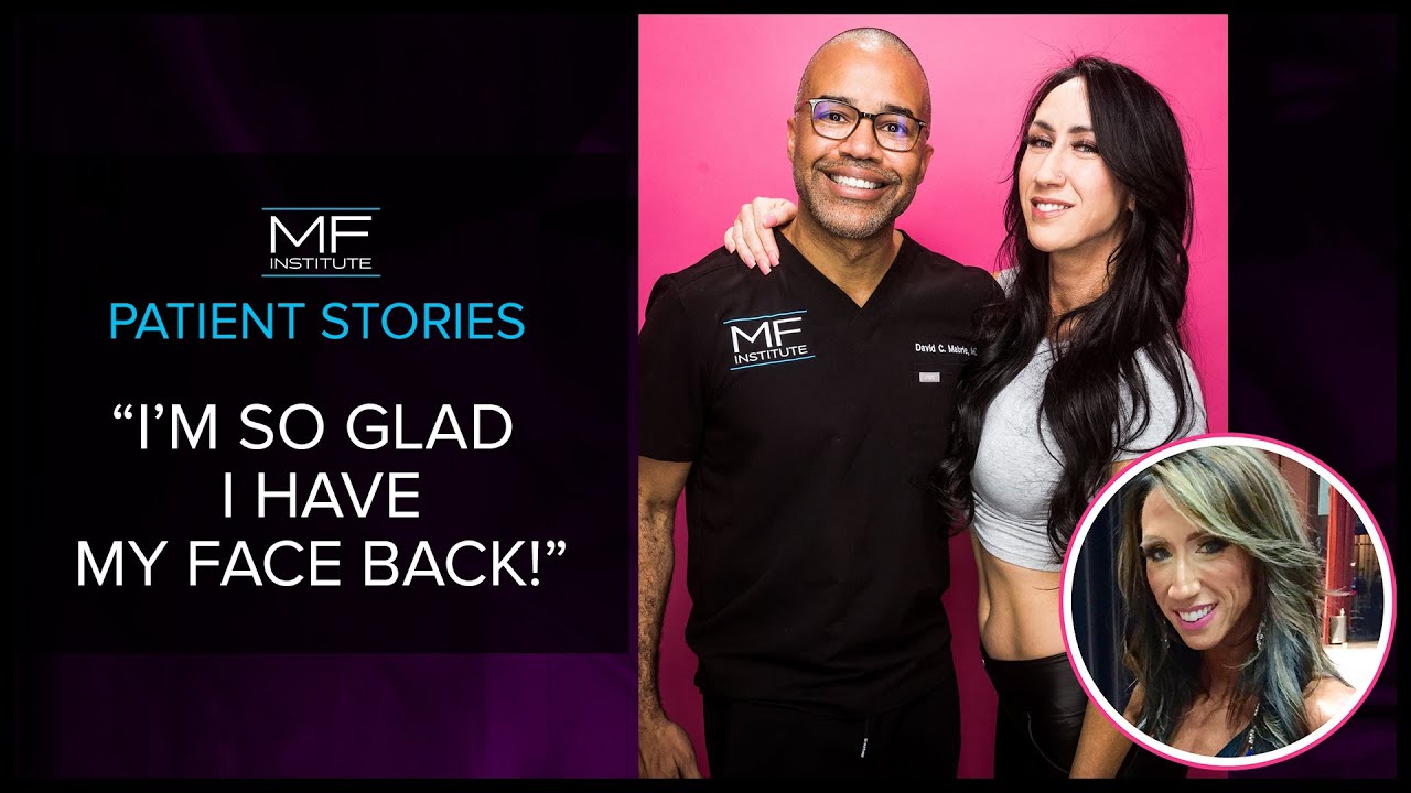 Using Fillers to Address Bodybuilder's Weight Loss-Related Concerns