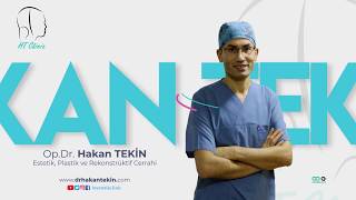 Op Dr Hakan Teki̇n - Yağ Dolgusu