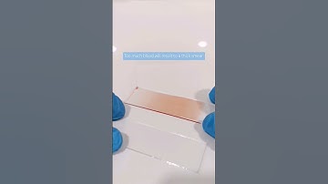 All about Bloodsmear Part 2 #laboratory #mls #cls #medtechstudent #blood #peripheralbloodsmear