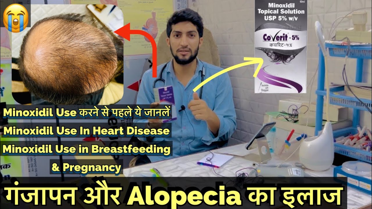 Minoxidil Topical Solution Hair Loss Treatment Minoxidil Use, Side