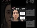 【クマ取り】美容部員は絶対やってる!頑固なクマにはこれが断トツ最強 #shorts