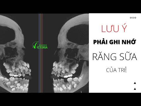 Những Lưu Ý