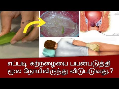 எப்படி கற்றழையை பயன்படுத்தி மூல நோயிலிருந்து விடுபடுவது | Tamil Health Tips – Tamil Info