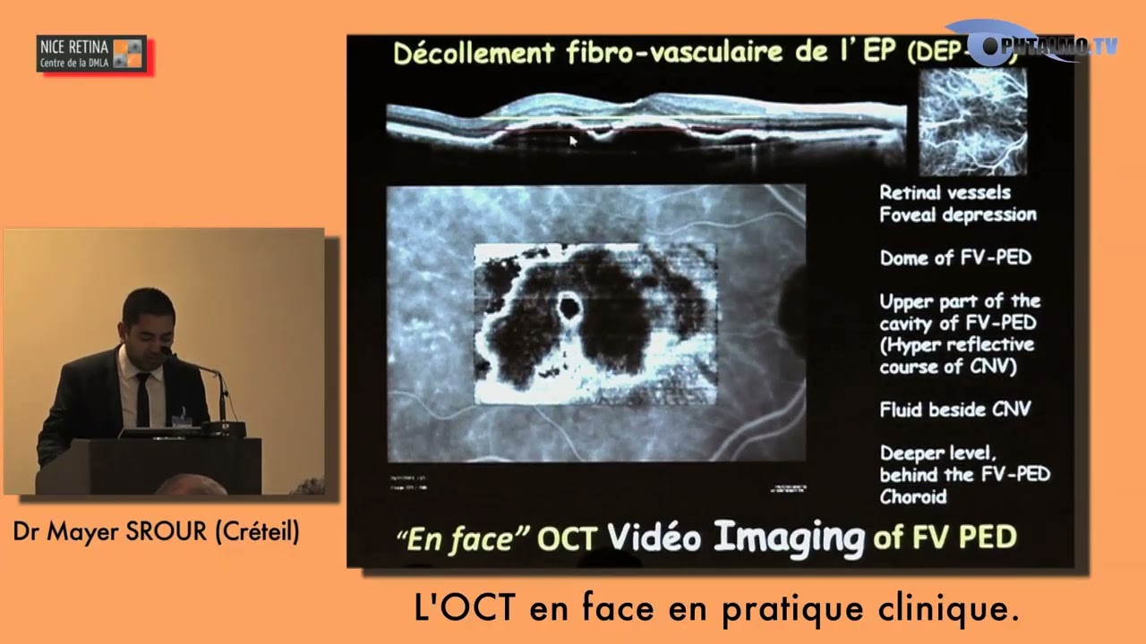 Dr Mayer Srour — L'OCT en face en pratique clinique (Nice Rétina 2015)