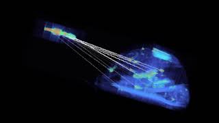 Famous Object Recognition using 3D SIFT in Complex CT Volumes Profile