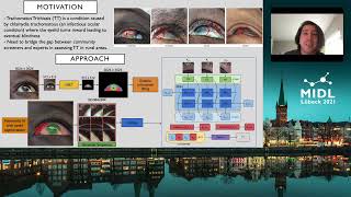 TT algorithm presentation