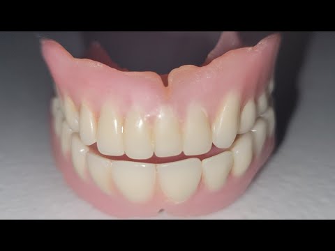 歯茎から義歯接着剤を取り除く方法。 #dentures