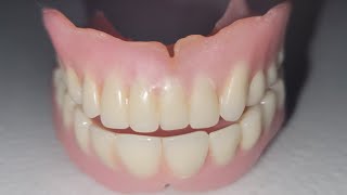How to remove denture adhesive from your gums. #dentures