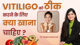 Vitiligo क ठक करन क लए कय खन चहए Best Diet Plan For Vitiligo Patients