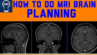 How to do an MRI brain: MRI brain planning, positioning, and protocol