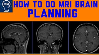 How to do MRI brain. MRI brain planing. MRI Brain position.Mri brain protocol