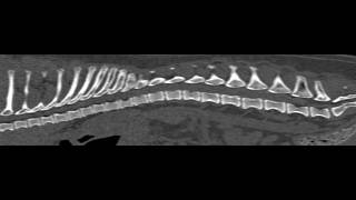 How to Select the Best Imaging Test for Spinal Disease