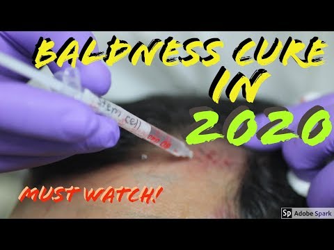finally-a-hair-loss-cure-in-2020!-(dr.-takashi-tsuji)