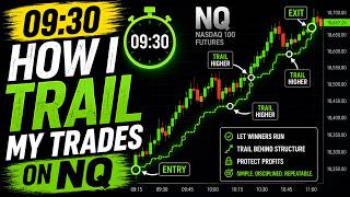 My Exact NQ Trade Management at 09:30 ⏰