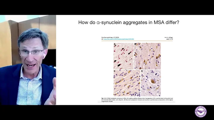 "Can infections trigger MSA?" - Patrik Brundin, MD, PhD