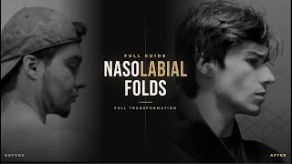 The Real Reason you have Nasolabial Folds