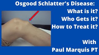 Osgood Schlatter's Disease: What is it? Who Gets it? How to Treat it? screenshot 3