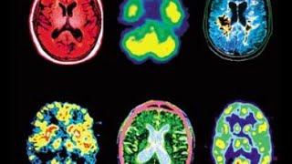RTU BS Medical Imaging