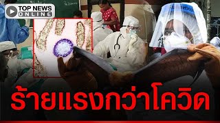 Download Lagu อินเดียวิกฤต สั่งล็อกดาวน์กลุ่มเสี่ยง เร่งสกัด “ไวรัสนิปาห์” โผล่อุบัติขึ้นร้ายแรงกว่าโควิด MP3