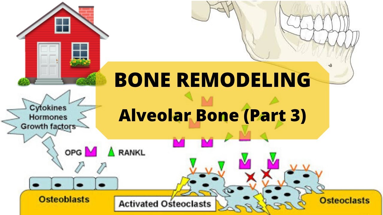 BONE REMODELING ( Alveolar Bone Part 3 ) YouTube