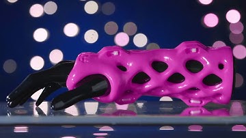 JOI is Proud to Offer ActivArmor Casts and Splints