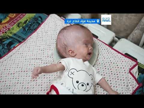 تداعيات الحرب وتدمير الذكريات في اليمن